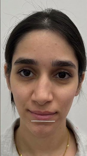 Cosmetic Surgery Before & After: Real Patient Transformations, Recovery Truths & Results That Last