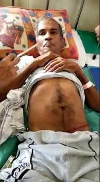 Significance of Abdominal reflex- By Dr. Sourya Acharya, Prof Dept. of Medicine, JNMC