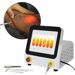[Hot Item] 2022 Hot Sale Laser Liposuction Device Vaser Fat Remove Lipomas