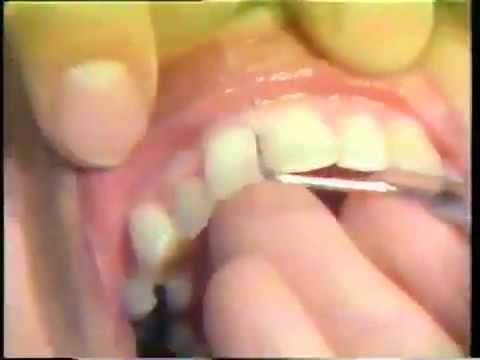 Examination Instruments