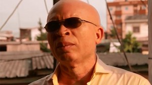 The albino journalist who challenged a witchdoctor using albino body parts in his potions
