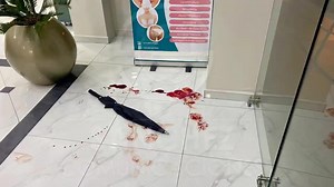 6K views · 93 reactions | Violento asalto #Ambato  #OrionInformativo En 13 minutos, al menos seis delincuentes se llevaron una suma importante de dinero y otros objetos tras irrumpir en una casa de salud, al norte de la ciudad. Los vecinos de #Izamba están organizados para prevenir futuros hechos delictivos. Fuente: Sanchez comunicaciones | ORION TV | Facebook