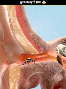 “An Insect Inside the Ear 😱?”#shorts