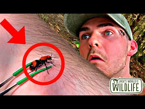 STUNG by a COW KILLER VELVET ANT