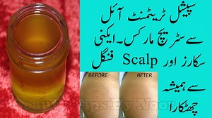 Homemade Treatment Hip Oil Removed Stretch Marks, Acne Scar and Scalp Fungal Permanently 100 % Work https://www.youtube.com/channel/UCiCTkfE7icAteaOux0evqMw?view_as=subscriber | Noor Skin Care