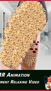 28K views · 122 reactions | Trypophobia infested foot danger parasite #asmr #tiktok | WOW Brain | Facebook