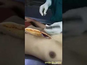 Post Mortem of a Female Dead Body || Woman Body Autopsy || যেভাবে পোস্ট মর্টাম করা হয়, লাশ কাটা হয়