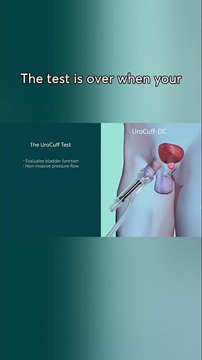 How Simple is a UroCuff Test