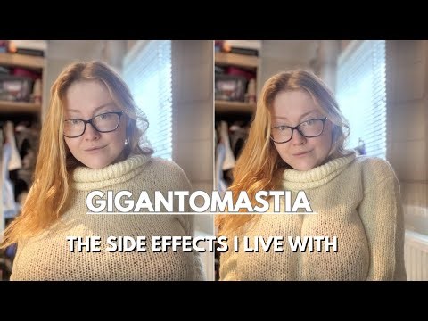 Gigantomastia, the side effects I live with