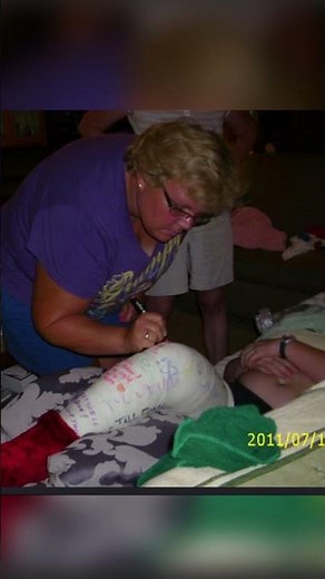 2 Pink and White Long Leg Casts- Broken Leg w/ cast wedging