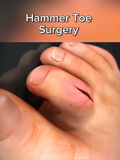 3D Visualization in Anatomy Education