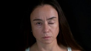 Adult Woman Shows Signs Strabismus Ophthalmology Stock Footage Video (100% Royalty-free) 1063086691 | Shutterstock