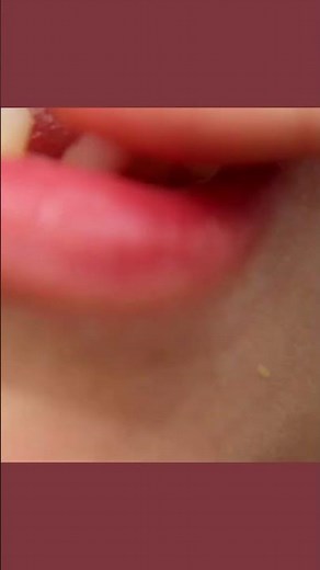 Loose Tooth 🦷 Wiggle Wiggle😁