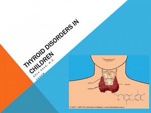 Thyroid disorders in children - SlideServe