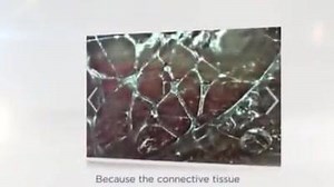 The FaciaBlaster™ BREAKS UP FAT CELLS like popping a balloon! This is an incredible, almost-too-good-to-be-true discovery, especially in the #fitness industry where "spot reduction" is unheard of. NOW you can break up those stubborn fat pockets with the FasciaBlaster™! Discover the #FasciaBlaster™ - Reduce the appearance of “#cellulite” - Restore your #fascia - Break down #fat cells (spot reduction!!!) - Improve #muscle performance - Reduce #pain & #inflammation - Accelerate muscle recovery & pe