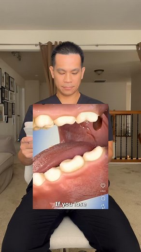 1K views | Reacting to losing an adult tooth #elkgrovedentist #dentaltips #californiadentist | Meadowbrook Family Dental | Facebook