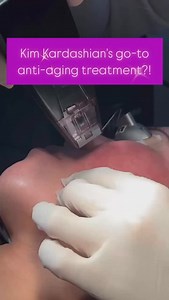 This is the Morpheus 8 treatment 朗 Morpheus 8 is a treatment that...