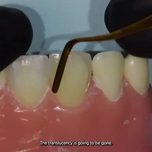 This Webinar Wednesday highlight features Bob Margeas, DDS, FAGD teaching "Creating a Direct Composite Veneer that Rivals Porcelain." As you can see, this webinar has a live hands-on portion that takes you step-by-step through building a porcelain veneer. Sign up or sign in to watch this webinar full of composite bonding pearls: https://bit.ly/3IuOsyM | Cosmedent