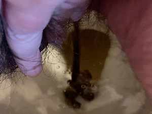 Urgent Loose Second Shit