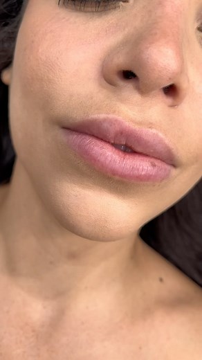 3 comments | Lip Blush by Lisandra  Results can last 2-5 years, with care* Lip Blush is a pop of color to one’s own natural lip. #lipblush #lipblushmiami #lipblushfortlauderdale #lips | The Brow Effect & Academy | Facebook