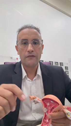 Laparoscopy and hysteroscopy are important before IVF in selected cases: To evaluate the uterus and fallopian tubes To remove fibroids, polyps, or adhesions To treat endometriosis To improve implantation and pregnancy success These procedures increase the chance of successful IVF outcomes. تنظير البطن وتنظير الرحم مهمان قبل أطفال الأنابيب في بعض الحالات: لفحص الرحم وقنوات فالوب لإزالة الأورام الليفية أو اللحميات أو الالتصاقات لعلاج بطانة الرحم المهاجرة لتحسين فرص الانغراس والحمل هذه الإجراءات تس