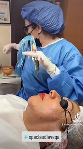 Full lips la experiencia hace la excelencia y solo en SpaClaudiaVega 8332721133 | SPA Claudia VEGA