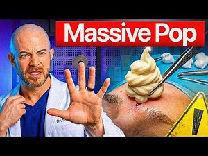These Pimple Pops Made a Dermatologist's Stomach Turn