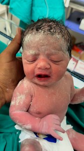 What are the chances of a successful vaginal birth after a previous Lower Segment Caesarean Section delivery殺 #baby #cutebaby #delivery #newborn #cute #birth #nicubaby | After delivery baby | Facebook