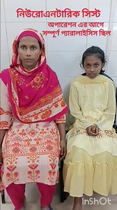 নিউরোএনটারিক সিস্ট (Neuroenteric cyst/ enterogenous cyst): অপারেশন এর আগে সম্পূর্ণ প্যারালাইসিস রোগী এখন সম্পূর্ণ সুস্থ! মেরূদনডের স্পাইনাল কর্ড এর উপর চাপ দিয়ে ধীরে ধীরে সম্পূর্ণ প্যারালাইসিস করে ফেলেছিল ১১ বছরের এই মেয়েটিকে! | Neurosurgeon Dr. Md. Ziauddin