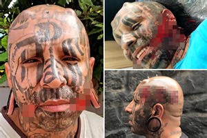 World’s worst body modification as man peels flesh to look like Demon