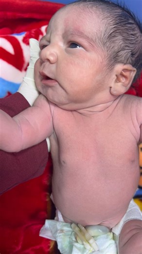 #babyfirstminutes Chubby baby with great reaction after Moro reflex 👶👶