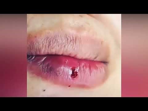 Dr. Popper's Extreme Pops! You Can't Touch This