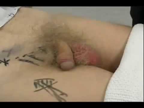 HERNIA EXAMINATION FOR STUDENTS