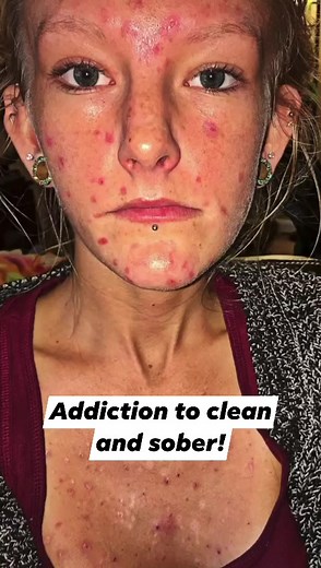 Amazing transformation!!! | United Recovery Project