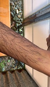 171K views · 1.1K reactions | 洛PLAGAAAAAAS DE GARRAPATAS EN LA SELVA las garrapatas en Costa Rica no son de problema médico! Aunque nunca se sabe ‼️‼️‼️﫥 #costarica #mexico #viral #fyp #reelsfyp #xyzbca #thailand #spider #insect #jungle | AbiMalz | Facebook