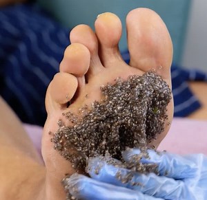 35K views · 107 reactions | Washing feet is everything! | 5-Minute Crafts Family | Facebook