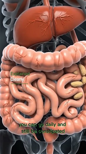Daily pooping doesn’t mean healthy digestion #HealthExplained #DigestiveHealth #Constipation #Human