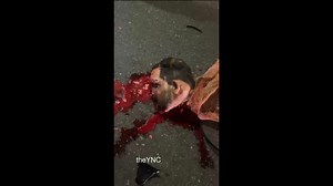 Couple Dies In Terrible Motorcycle Accident