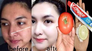 Colgate toothpaste for face whitening! Skin Whitening remedy! Skin whitening masks with toothpaste #glowingskin #antiaging | Natural Beauty Remedy