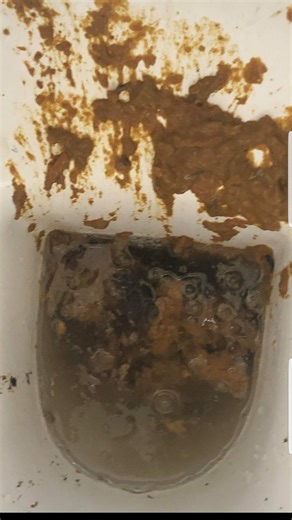 In bowl view desperate loose curry shit at my mates girlfriends place