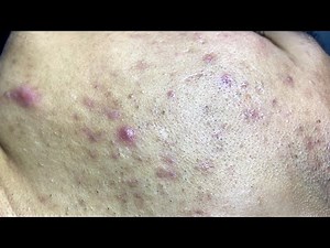 Relax Every Day With Mun Spa #29