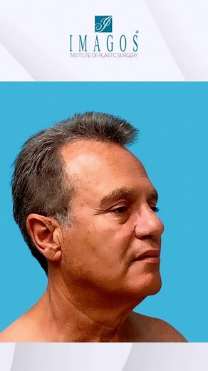 Imagos Plastic Surgery on Reels | Facebook