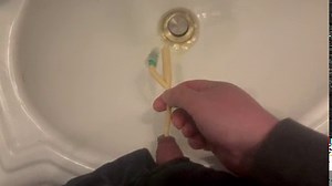 Bladder Release Through Catheter