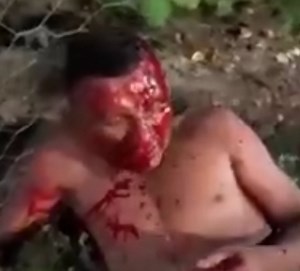 Punishment for a thief in Brazil