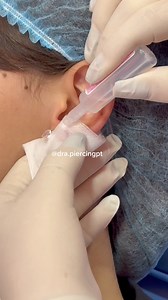 3.1M views · 7.4K reactions |  **Atenção, Pais e Mães!**  **Não deixe os brincos das suas crianças apertados!** Evite o doloroso encapsulamento no lóbulo. Assista ao meu vídeo de 3 minutos e veja a dificuldade que é para remover a joia quando isso acontece. Cuide do conforto e segurança dos pequenos!  曆Proteja o sorriso e bem-estar | Dra Piercing | Facebook