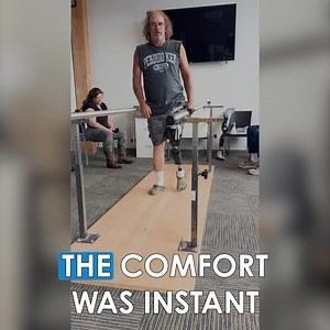 105 reactions · 4 comments | Conventional sockets are hot, rigid and often uncomfortable. The Socket-less Socket™ is breathable, conforming and has micro-adjustable comfort. | Martin Bionics | Facebook