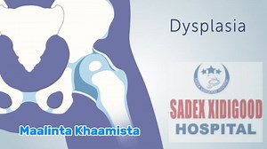 Saddex Xidigood HOSPITAL Bosaaso dhaqtarka lafaha laga dhigay lacag la aan maalinkasta oo khamiis ah labagalin FIIRO GAAR AH kabayga lafaha jabay waxaa laguugu qabanayaa bilaash maalin walba. Kafaa iidaysiwacan. Laanta kowaad Saddex xidigood Hospital Bosaso ee kutaal Masjidu Rashid Wixii faah faahin ah wac 5668573 ama 7668777 Bosaso Tv | Bosaso Tv