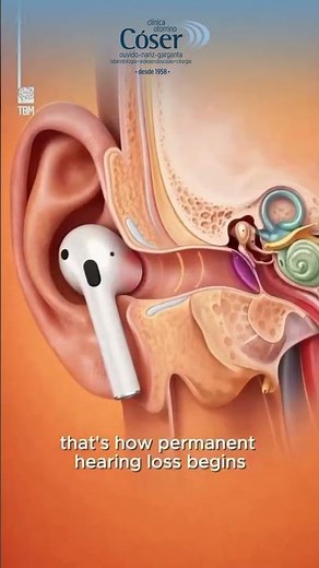 Noise-Induced Hearing Loss and Acoustic Trauma