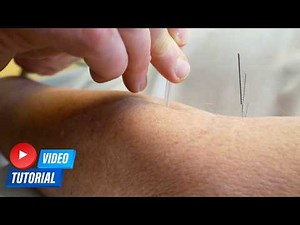 EASY Acupuncture for Beginners! Step by Step Tutorial