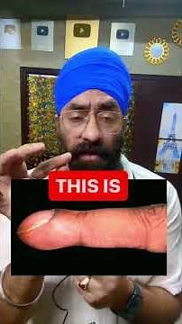 Digital clubbing aka clubbed fingers or fingers clubbing | Dr. Education